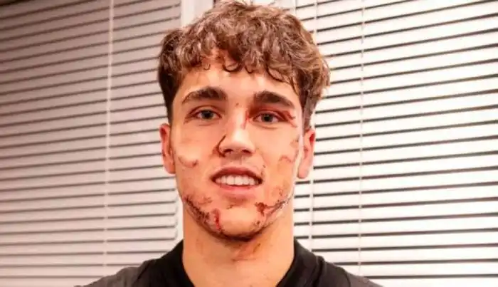 Pese a la fuerte entrada y tras pasar el susto, Cubarsí no dejó de sonreir. / FC Barcelona